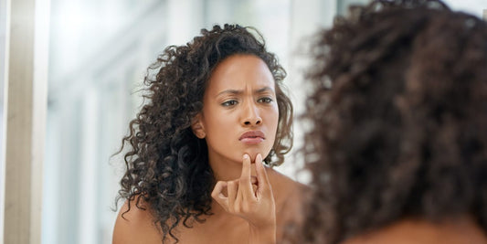 Skin Purging vs. Breakouts: What Botanical Bliss Users Should Know